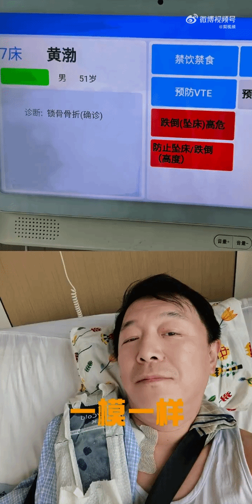 黄渤骑车摔骨折调侃像拍戏 提醒骑行勿分心