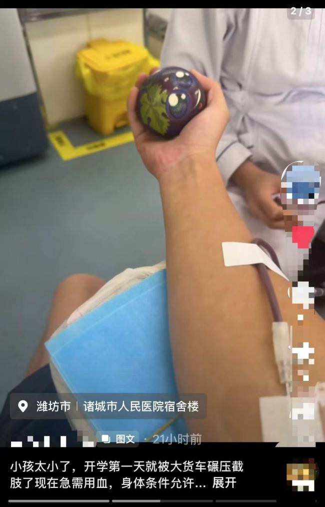 遇车祸截肢女孩尚未苏醒右腿伤情不明 爱心献血接力相助
