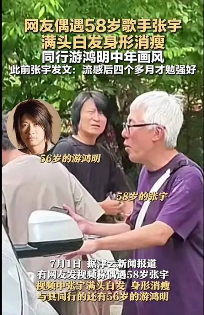 经纪人回应张宇满头白发:停工后鲜少再染黑发