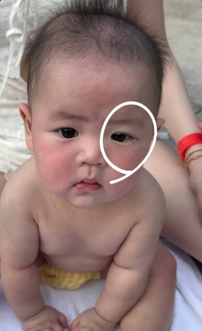欧阳妮妮透露儿子鼻泪管阻塞 将进行疏通手术